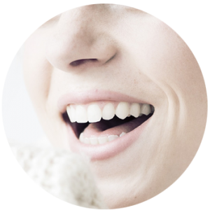 dental bridges