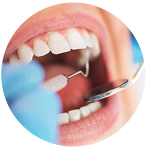 tooth wear