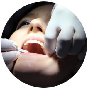 fillings