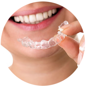invisalign