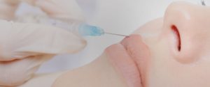 botox treatment